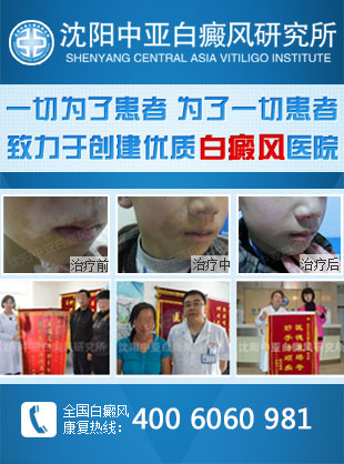 辽宁治疗白癜风哪家医院好 辽宁治疗白癜风哪家医院好
