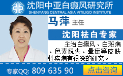 沈阳白癜风医院怎么样?